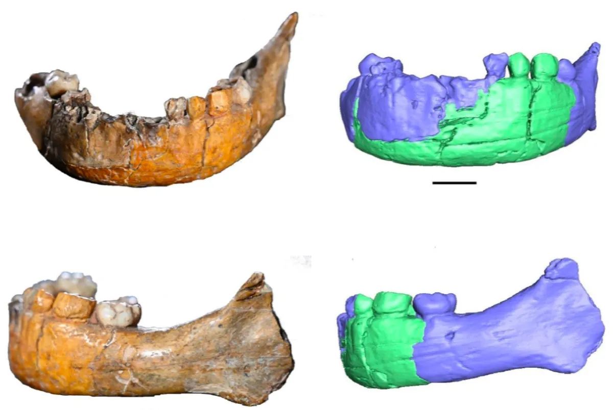 Mandíbula e dentes
